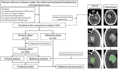 A CT-based radiomics nomogram for classification of intraparenchymal hyperdense areas in patients with acute ischemic stroke following mechanical thrombectomy treatment